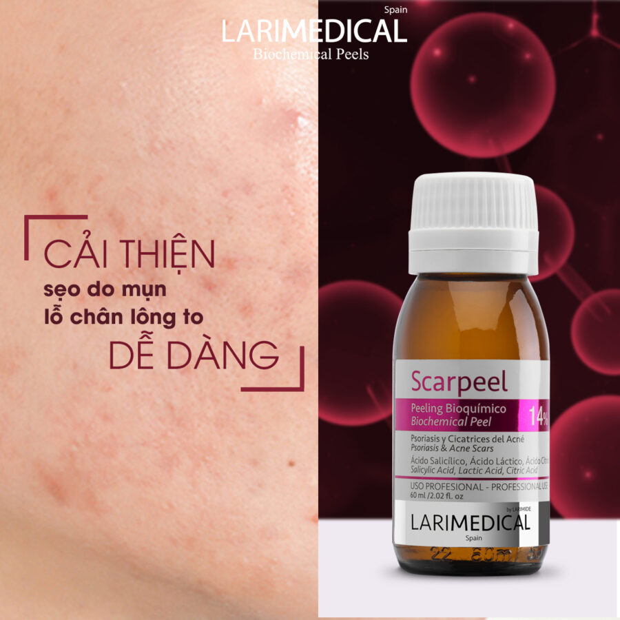 SCARPEEL LARIMEDICAL  - ĐIỀU TRỊ SẸO MỤN, LỖ CHÂN LÔNG TO